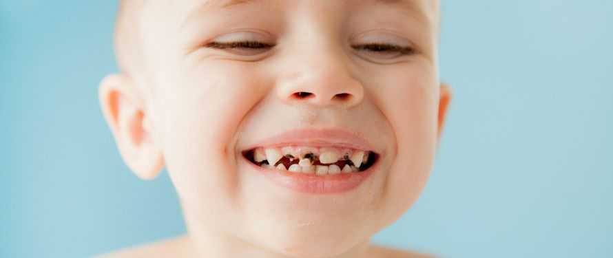 Ways To Help Kids Keep Teeth Clean