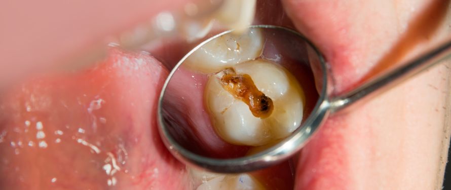 When To See A Dentist